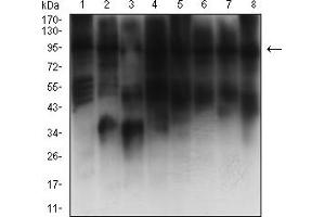 Western Blotting (WB) image for anti-K(lysine) Acetyltransferase 2B (KAT2B) (AA 1-142) antibody (ABIN7193343)