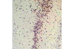 Immunohistochemical analysis of CABP2 staining in rat brain formalin fixed paraffin embedded tissue section. (CABP2 antibody)