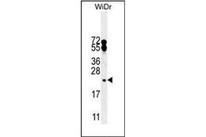 Western blot analysis of FAM96A Antibody (C-term) in WiDr cell line lysates (35ug/lane).