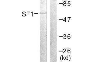 Western Blotting (WB) image for anti-Splicing Factor 1 (SF1) (Ser82) antibody (ABIN1847974) (Splicing Factor 1 antibody  (Ser82))