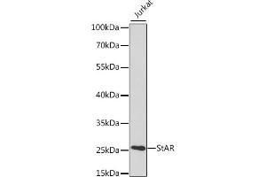 Western blot analysis of extracts of various cell lines, using StAR antibody (ABIN3021302, ABIN3021303, ABIN3021304 and ABIN6214574) at 1:400 dilution. (STAR antibody  (AA 64-285))