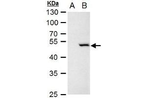 WB Image Chk1 antibody [C1C2-6], Internal detects Chk1 protein by western blot analysis.