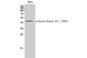 Western Blotting (WB) image for anti-Casein Kinase 2 alpha 1 (CSNK2A1) (pTyr255) antibody (ABIN3173062) (CSNK2A1/CK II alpha antibody  (pTyr255))