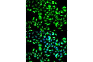Immunofluorescence analysis of U2OS cells using GBP1 antibody (ABIN5974159). (GBP1 antibody)
