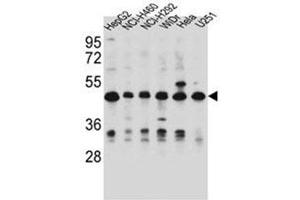 Western blot analysis of DUS1L Antibody (C-term) in HepG2, NCI-H460, NCI-H292, WiDr, Hela, U251 cell line lysates (35ug/lane).