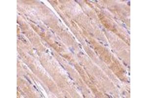 Immunohistochemistry (Paraffin-embedded Sections) (IHC (p)) image for anti-Emerin (EMD) (N-Term) antibody (ABIN499790)