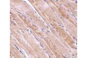 Immunohistochemistry of emerin in human skeletal muscle tissue with emerin antibody at 2. (Emerin antibody  (N-Term))