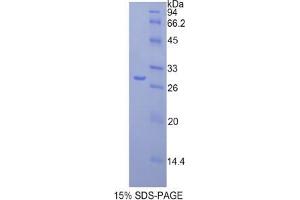SDS-PAGE (SDS) image for Fatty Acid Synthase (FASN) (partial) protein (His tag) (ABIN3009348)