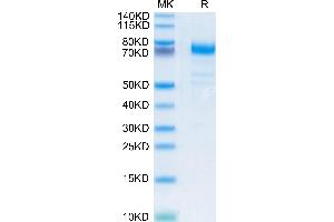 Human CD36/SR-B3 on Tris-Bis PAGE under reduced condition. (CD36 Protein (CD36) (AA 30-439) (His-Avi Tag))