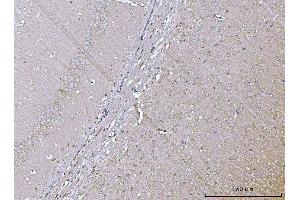 IHC analysis of VPS53 using anti-VPS53 antibody (ABIN7599731). (VPS53 antibody  (AA 11-699))