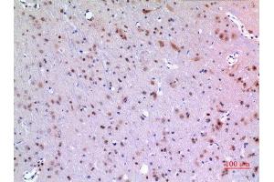 Immunohistochemistry (IHC) analysis of paraffin-embedded Rat Brain, antibody was diluted at 1:100. (MANF antibody  (Internal Region))