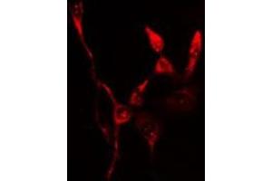 ABIN6276547 staining  Hela cells by IF/ICC. (FTH1 antibody  (C-Term))