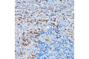 Immunohistochemistry of paraffin-embedded mouse spleen using Gelsolin Rabbit pAb (ABIN7267365) at dilution of 1:50 (40x lens).