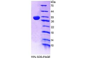 SDS-PAGE (SDS) image for Phospholipase C, epsilon 1 (PLCE1) (AA 1-250) protein (His tag) (ABIN6239514) (PLCE1 Protein (AA 1-250) (His tag))