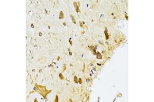 Immunohistochemistry of paraffin-embedded rat spinal cord using RPL13 Antibody (ABIN2559760) at dilution of 1:100 (40x lens). (RPL13 antibody)