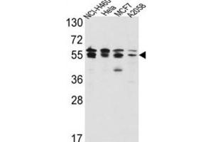 Western Blotting (WB) image for anti-IMP (Inosine 5'-Monophosphate) Dehydrogenase 2 (IMPDH2) antibody (ABIN3003184) (IMPDH2 antibody)