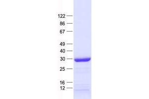 Validation with Western Blot