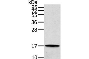 Western Blot analysis of Human cecum carcinoma tissue using REG3A Polyclonal Antibody at dilution of 1:200 (REG3A antibody)