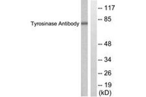 Western blot analysis of extracts from COS7 cells, treated with UV 30', using Tyrosinase Antibody. (TYR antibody  (AA 471-520))