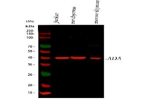 Western blot analysis of ADA using anti-ADA antibody (ABIN4886424).