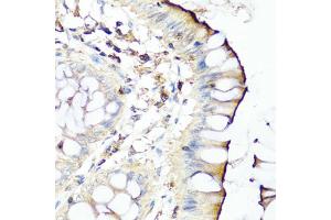 Immunohistochemistry of paraffin-embedded human colon using SERPINA7 antibody (ABIN5975019) at dilution of 1/100 (40x lens).