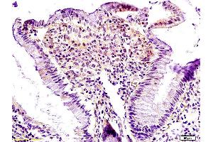 Formalin-fixed and paraffin embedded rat colon labeled with Anti Lpin1 Polyclonal Antibody, Unconjugated (ABIN672831) at 1:200 followed by conjugation to the secondary antibody and DAB staining. (Lipin 1 antibody  (AA 201-300))