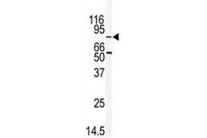 Western Blotting (WB) image for anti-MAP/microtubule Affinity-Regulating Kinase 2 (MARK2) (AA 600-630) antibody (ABIN3031689)