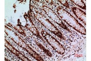 Immunohistochemistry (IHC) image for anti-Calcyclin Binding Protein (CACYBP) (C-Term) antibody (ABIN3187896)