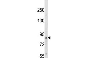 Western blot analysis of TrkA antibody and HepG2 lysate. (TRKA antibody  (AA 769-796))