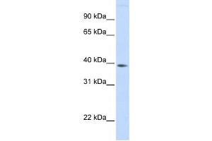 Western Blotting (WB) image for anti-Family with Sequence Similarity 76, Member B (FAM76B) antibody (ABIN2459566)