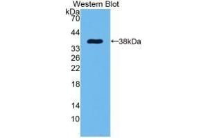 Detection of Recombinant EGF, Rat using Monoclonal Antibody to Epidermal Growth Factor (EGF) (EGF antibody  (AA 974-1026))