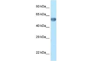WB Suggested Anti-Zkscan14 Antibody Titration: 1. (ZNF394 antibody  (C-Term))