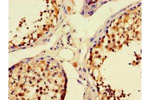 Immunohistochemistry of paraffin-embedded human testis tissue using ABIN7166245 at dilution of 1:100 (UNC13C antibody  (AA 414-645))