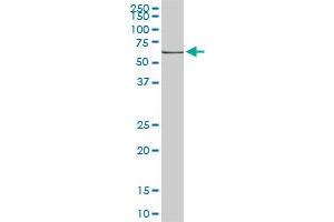 HSPA1B monoclonal antibody (M02), clone 3B7. (HSPA1B antibody  (AA 531-611))