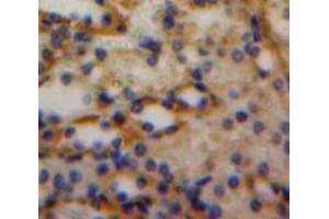 Used in DAB staining on fromalin fixed paraffin-embedded Kidney tissue (Luteinizing Hormone antibody  (AA 25-120))