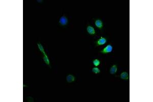 Immunofluorescence staining of A549 cells with ABIN7153853 at 1:66, counter-stained with DAPI. (GFAP antibody  (AA 292-432))
