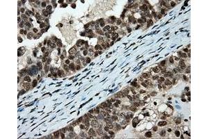 Immunohistochemical staining of paraffin-embedded colon tissue using anti-APP mouse monoclonal antibody. (APP antibody)