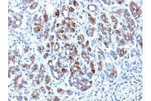 Formalin-fixed, paraffin-embedded human Pancreas stained with Alpha-1-Antichymotrypsin Mouse Monoclonal Antibody (AACT/1451) (SERPINA3 antibody  (AA 49-187))