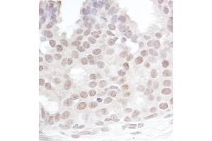 anti-Gem (Nuclear Organelle) Associated Protein 4 (GEMIN4) (C-Term) antibody