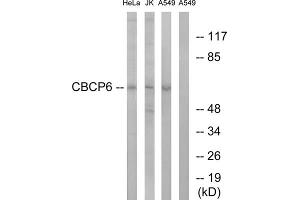 Western blot analysis of extracts from HeLa cells, Jurkat cells and A549 cells, using CBCP6 antibody. (AGBL4 antibody  (C-Term))