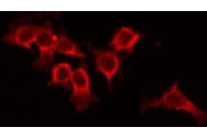 ABIN6266548 staining 293 by IF/ICC. (Metabotropic Glutamate Receptor 4 antibody  (C-Term))