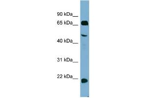 ZNF746 antibody  (Middle Region)