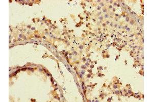 Immunohistochemistry of paraffin-embedded human testis tissue using ABIN7170749 at dilution of 1:100 (CYP17A1 antibody  (AA 1-508))