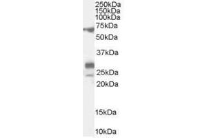 Image no. 1 for anti-Sal-Like 4 (SALL4) (Internal Region) antibody (ABIN374800) (SALL4 antibody  (Internal Region))