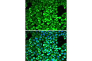 Immunofluorescence analysis of A549 cell using IPO5 antibody. (Importin 5 antibody  (AA 20-300))