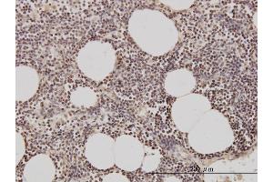 Immunostaining (ISt) image for anti-Geminin, DNA Replication Inhibitor (GMNN) (AA 110-209) antibody (ABIN565518)