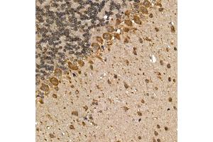Immunohistochemistry (IHC) image for anti-Muscarinic Acetylcholine Receptor M1 (CHRM1) (C-Term) antibody (ABIN3022211)
