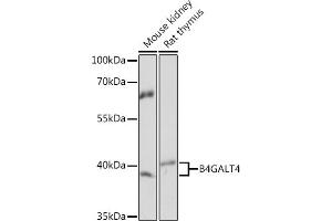 Western blot analysis of extracts of various cell lines, using B4G Rabbit pAb (ABIN7271201) at 1:1000 dilution.