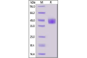 SDS-PAGE (SDS) image for Mesothelin (MSLN) (AA 296-580) (Active) protein (His tag) (ABIN7013457)