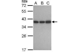 WB Image Sample (30 ug of whole cell lysate) A: 293T B: A431 C: Jurkat 12% SDS PAGE antibody diluted at 1:1000 (CAPZA1 antibody  (Center))